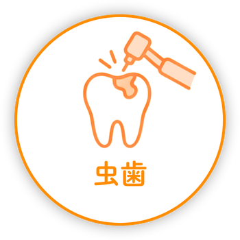 虫歯
