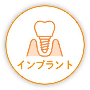 インプラント
