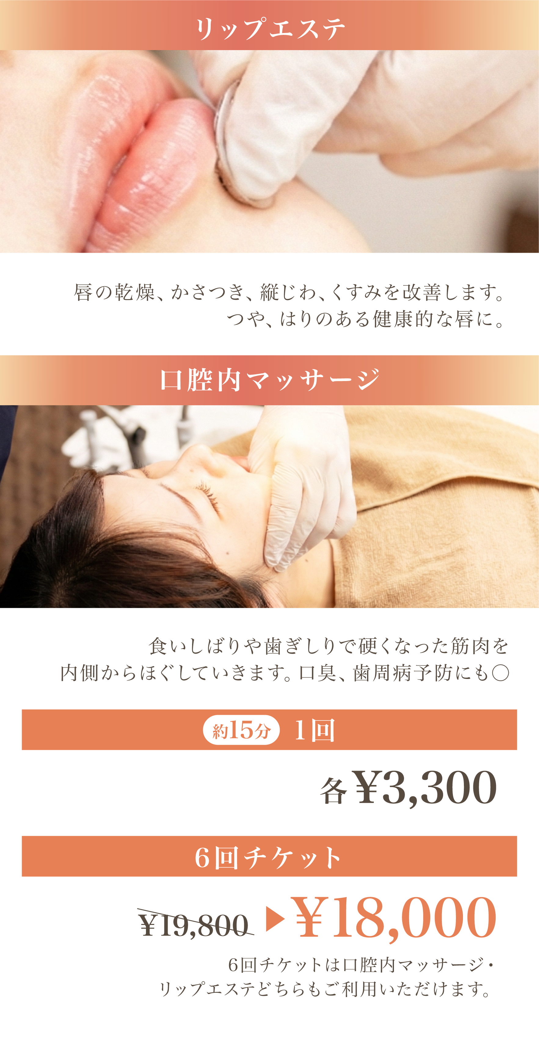 デンタルエステの料金2