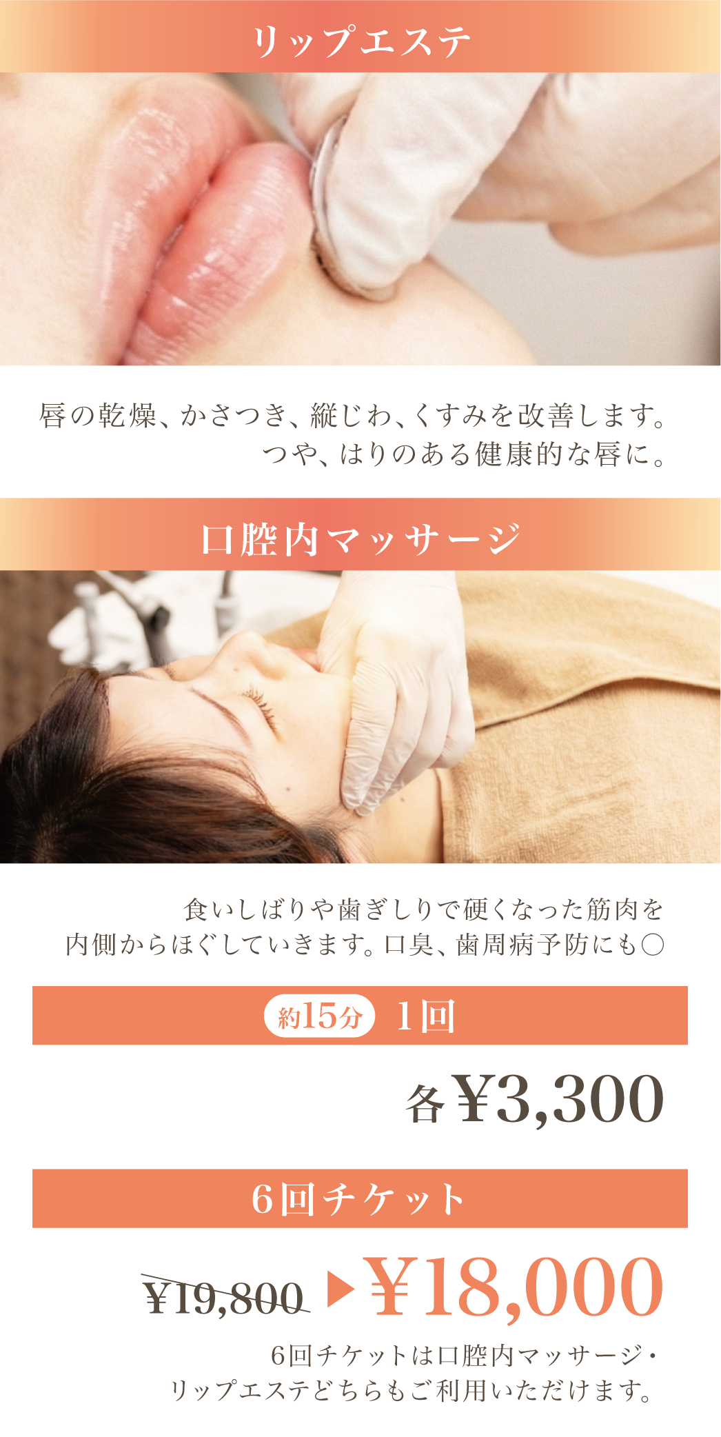 デンタルエステの料金2