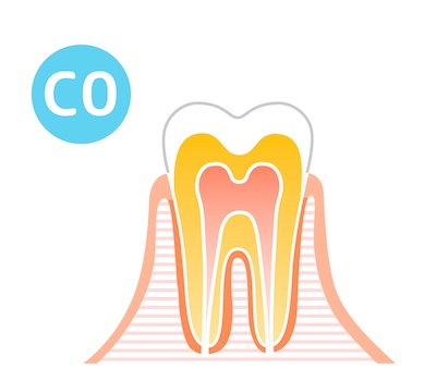 C0