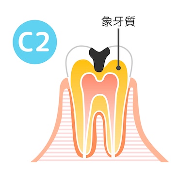 C2