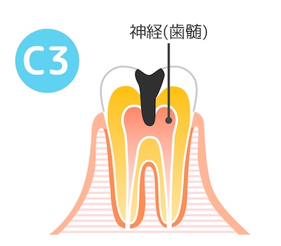 C3