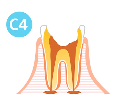 C4